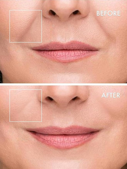 Microneedle Undereye Patches®